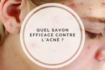 Quel savon efficace contre l'acné ?