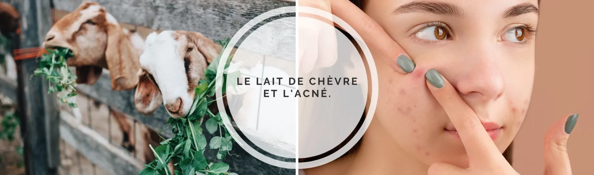 Le lait de chèvre et l&rsquo;acné.