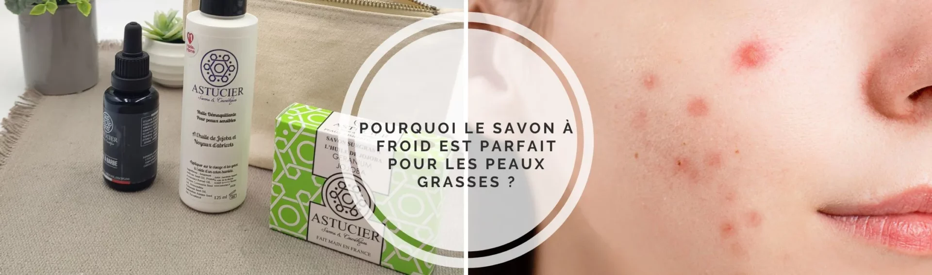 Pourquoi le savon à froid est-il idéal pour les peaux grasses ?