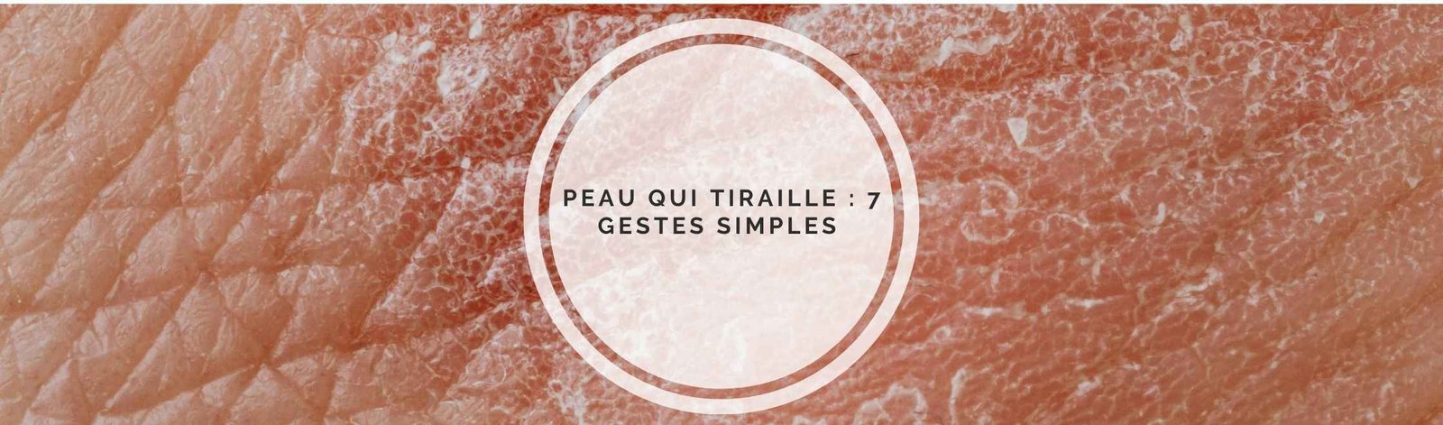 Peau qui tiraille : 7 gestes simples