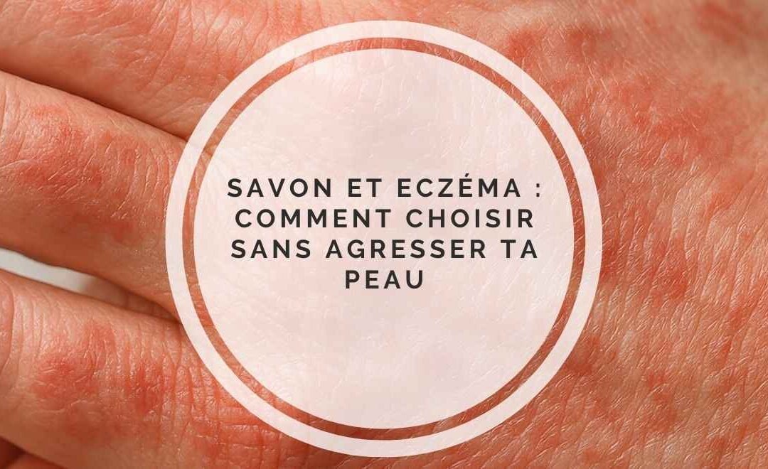 Eczéma : quel savon, soin choisir pour une peau apaisée, sans routine compliquée ?