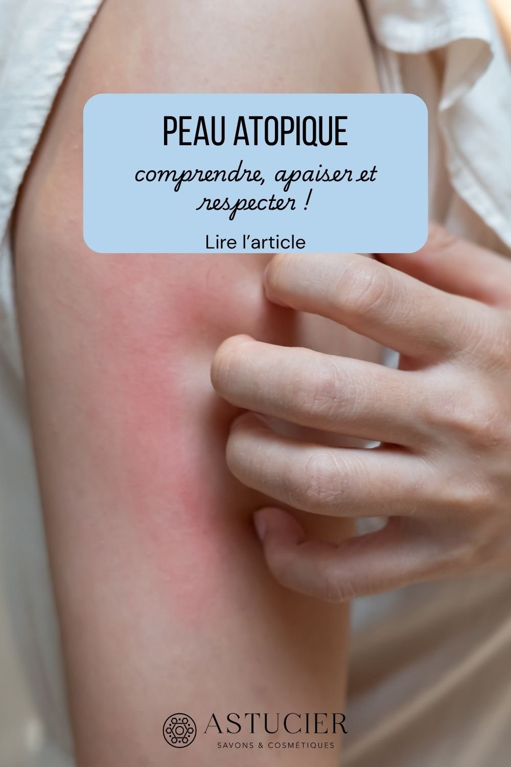 peau atopique (1000 x 1500 px) peau atopique