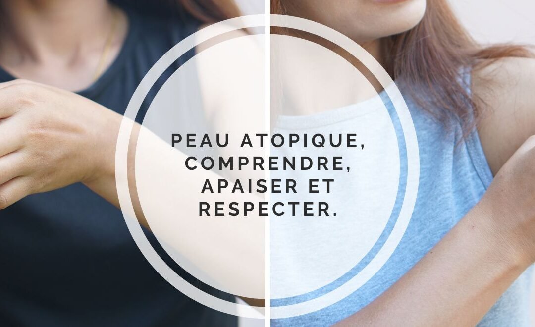 Atopic skin: understand, soothe and better respect a skin that reacts