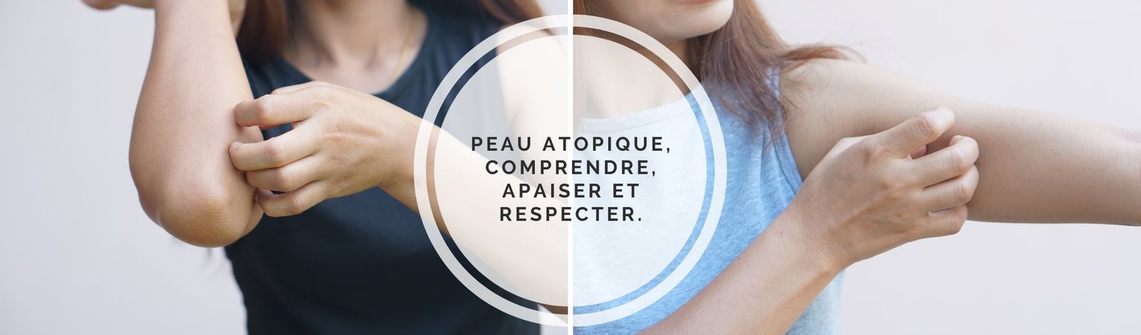 peau atopique