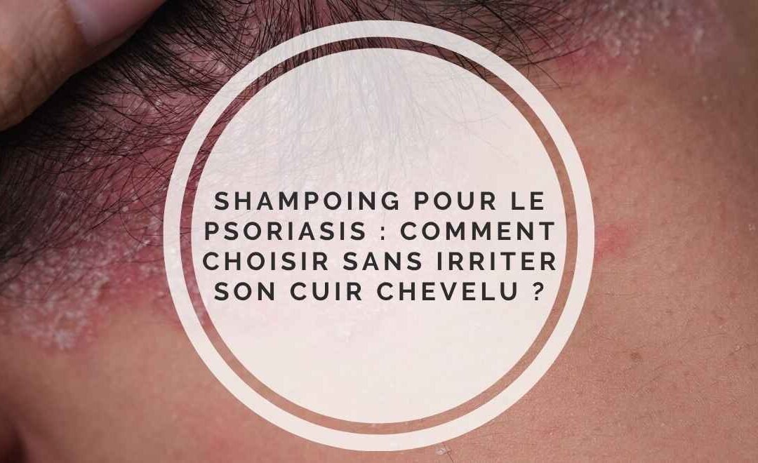 Shampoing pour le psoriasis : comment choisir sans irriter son cuir chevelu ?